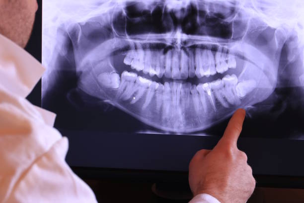 Best Cracked Tooth Emergency Dentist  in Meade, KS